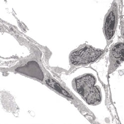 Transmission electron micrographs TEM of lung tissue vibration isolation